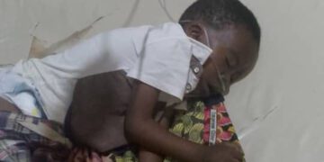 Mother of three-year-old, Jeremiah Simeon seeks N5m for son’s lifesaving heart surgery