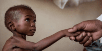 REPORT: European aid cuts could trigger millions of preventable deaths