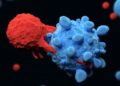 Experimental T-Cell therapy clears metastatic liver cancer in three-year-old boy