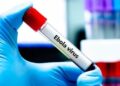 FG steps up Ebola response in Abuja as 44 contacts placed under monitoring 99 FG steps up Ebola response in Abuja as 44 contacts placed under monitoring