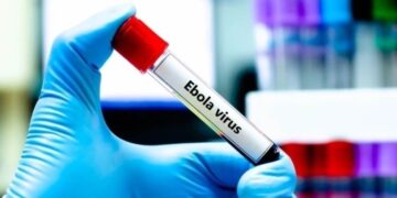 FG steps up Ebola response in Abuja as 44 contacts placed under monitoring 1 FG steps up Ebola response in Abuja as 44 contacts placed under monitoring