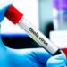 FG steps up Ebola response in Abuja as 44 contacts placed under monitoring 2 FG steps up Ebola response in Abuja as 44 contacts placed under monitoring